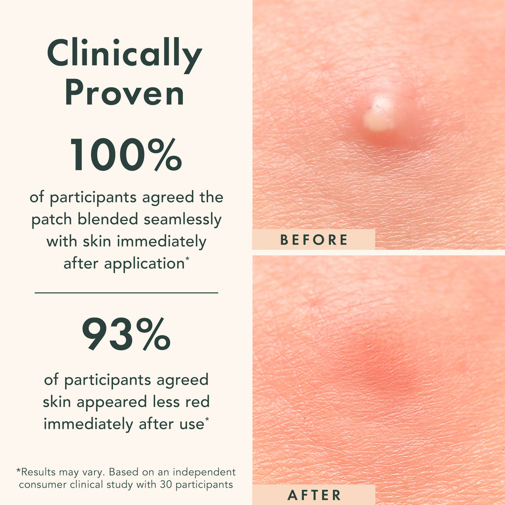 Miracle Patch Invisible Spot Cover